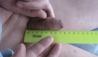 Messung der Größe des Penis